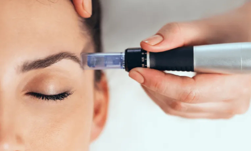 Dermapen